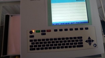 ekg decije odeljenje