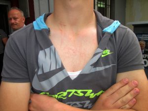 Loznica02 napadnut aktivista radikala decaku pokidana majica i izgreban vrat foto s.pajic_1000x0
