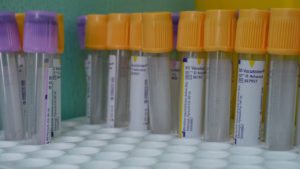 korona virus labaratorija2